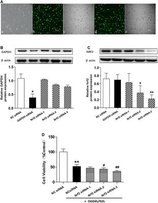 Chinese Herbal Preparation SaiLuoTong Alleviates Brain Ischemia via Nrf2 Antioxidation Pathway–Dependent Cerebral Microvascular Protection